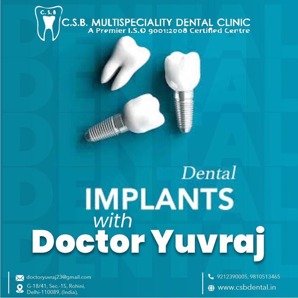 Implant Fusion with The Bone in rohini sector 15, Delhi
                                
